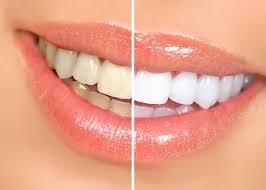 Այս բնական միջոցը կօգնի սպիտակեցնել ատամները, արդյունքը իրոք կզարմացնի