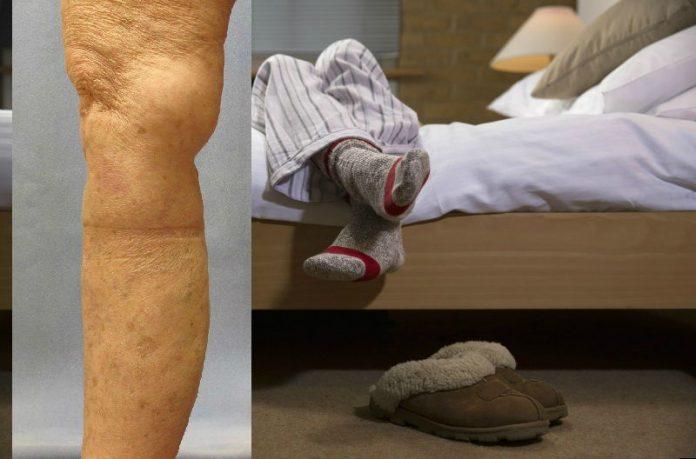 Вы чувствуете боль в ногах ночью или когда лежите в постели  У вас может быть синдром беспокойных ног  Вот, что нужно сделать