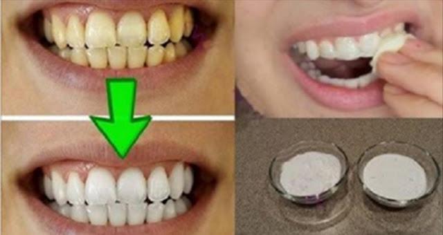 Гарантированное отбеливание зубов менее чем за 2 минуты! Очень эффективно!