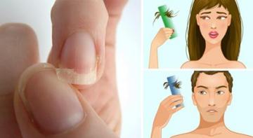 Если у вас тонкие ломкие ногти, выпадение волос или бессонница, начните потреблять это